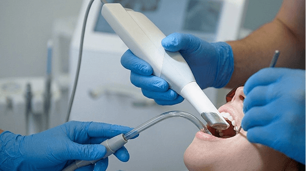 數碼口內掃描儀