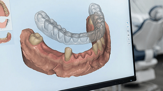 精確取模與掃描