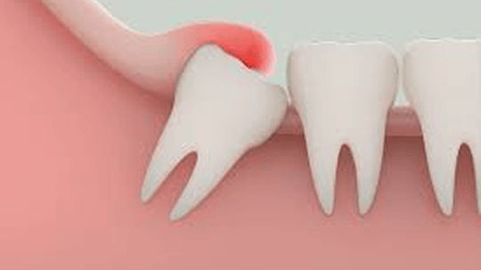 制定個人化手術方案