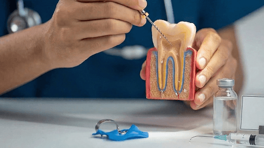 根管擴大與消毒