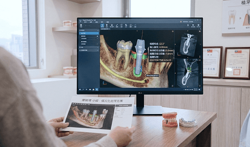 制定個人化方案