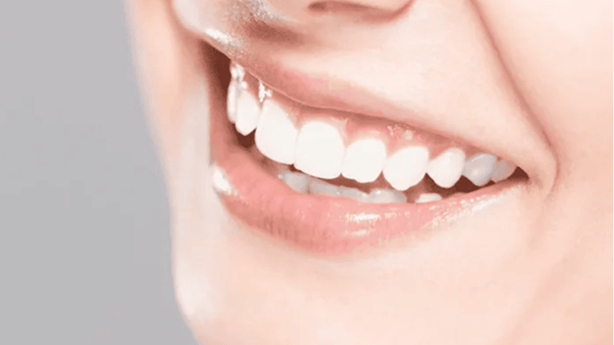 牙齒美白