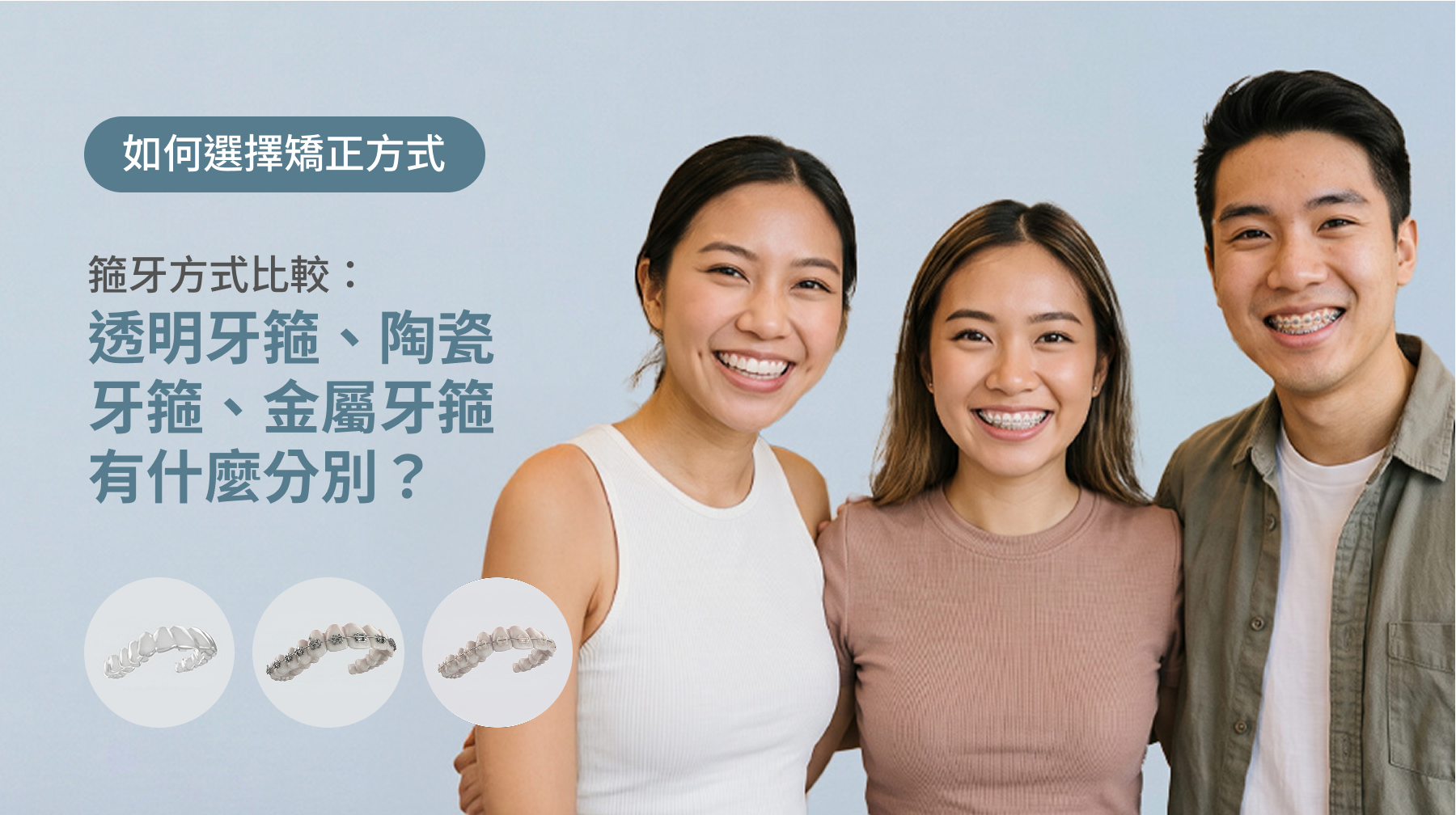 箍牙方式比較：透明牙箍、陶瓷牙箍、金屬牙箍有什麼分別？如何選擇適合自己的矯正方式？